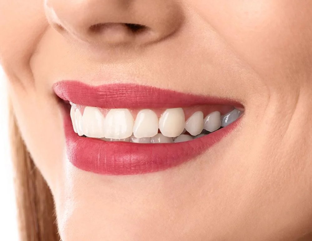 professional teeth whitening in NJ