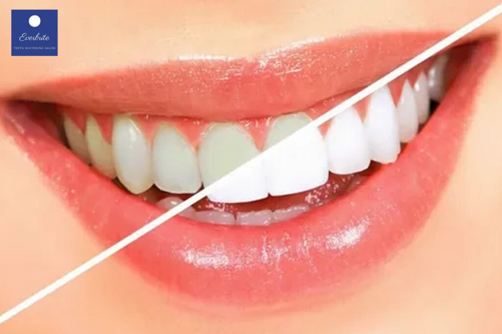 Teeth Whitening Near Me NJ