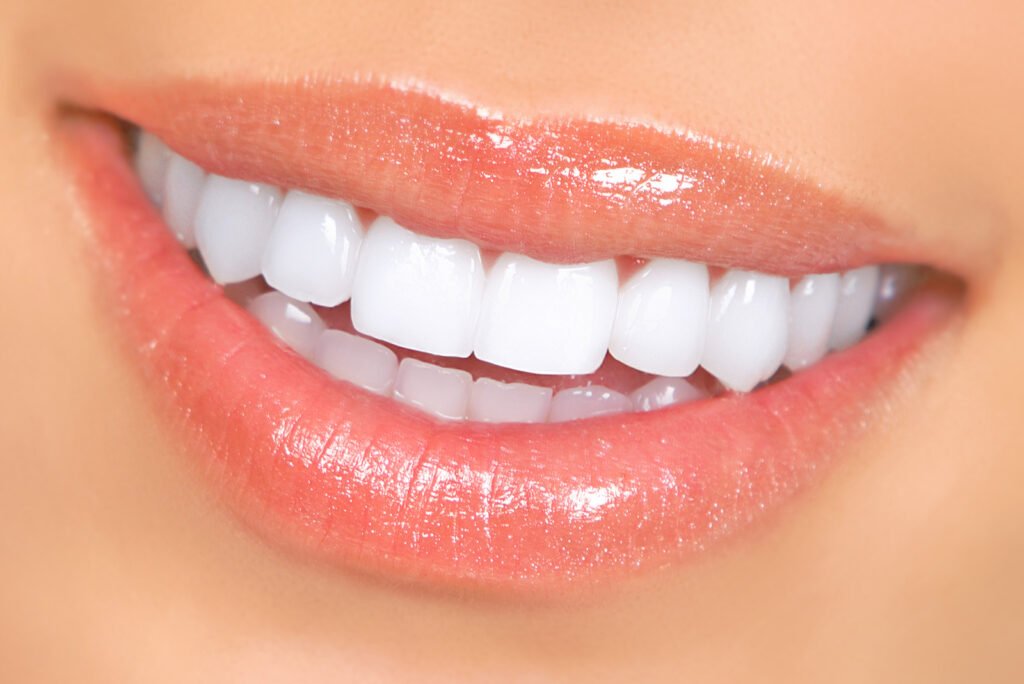 Teeth Whitening Services